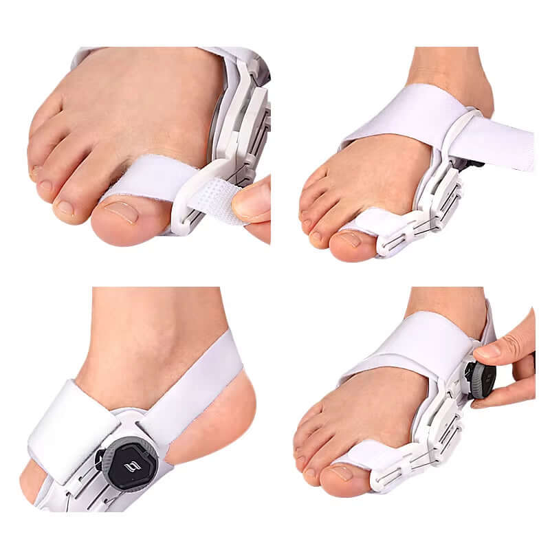 Unisex bunion corrector brace for foot with rotatable toe separator and adjustable straightening features.